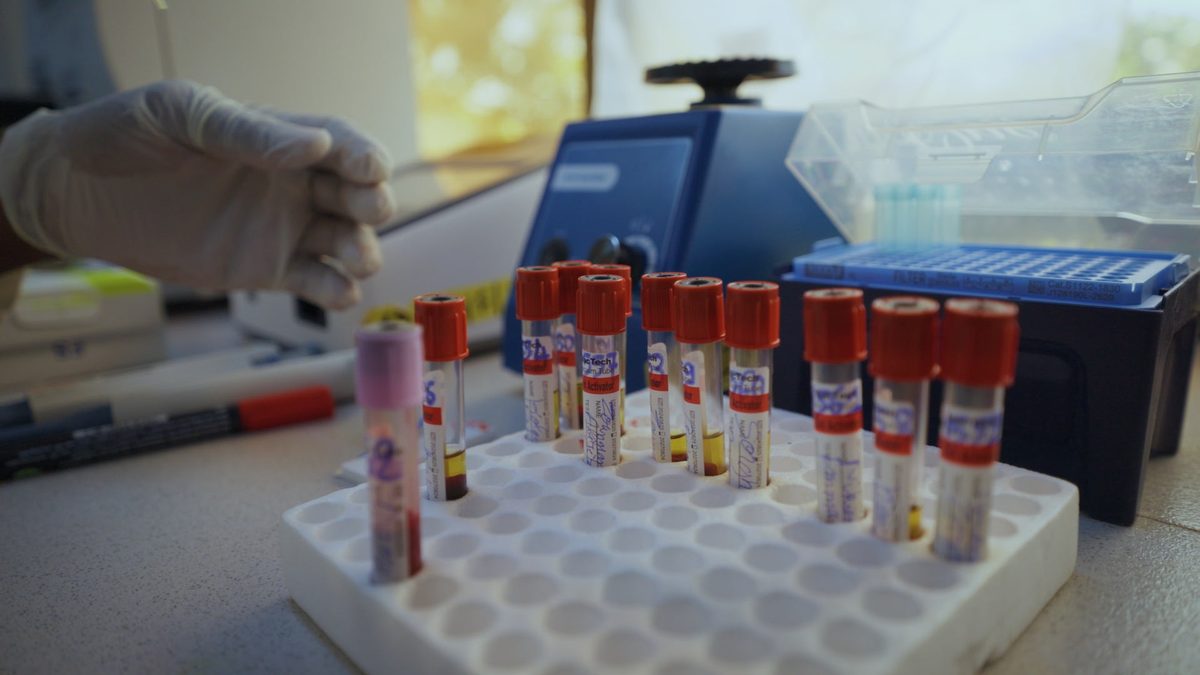 Laborproben in der AMPO-Krankenstation